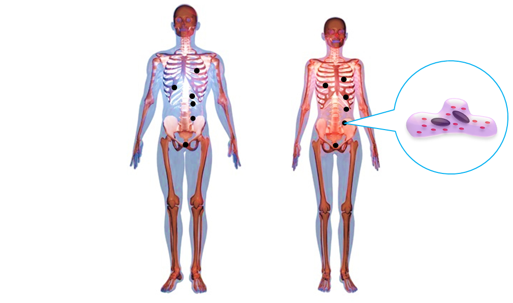 がんのできやすい部位