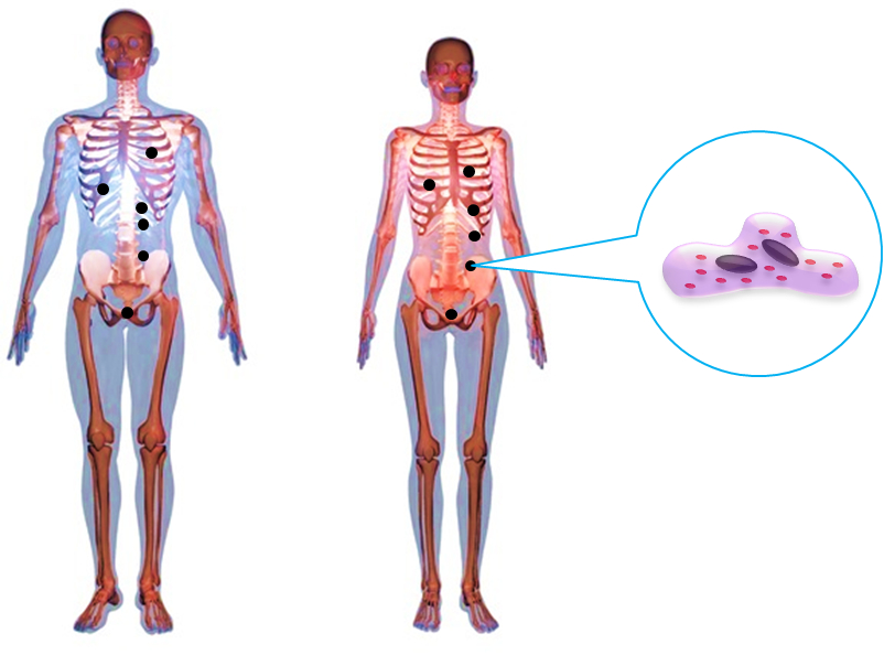 がんのできやすい部位