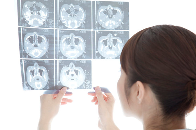 レントゲン写真を見る女性