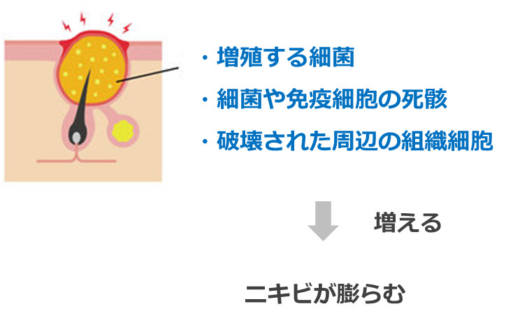 ニキビの中の成分