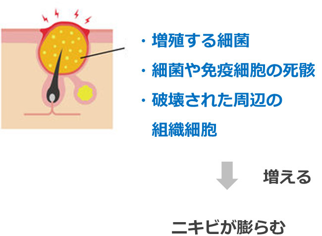 ニキビの中の成分