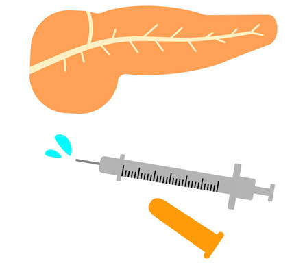 膵臓とインシュリン