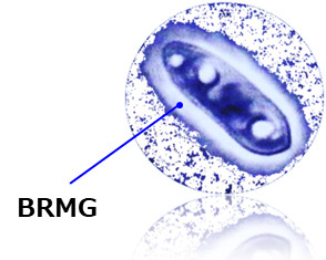 アウレオバシジウム　プルランス