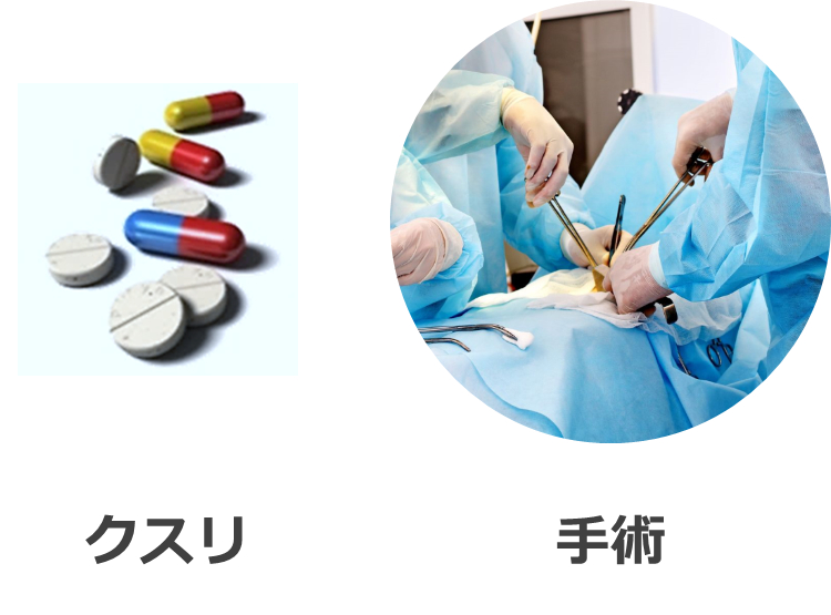 クスリと手術